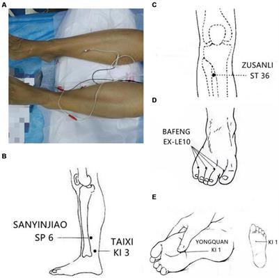 Acupuncture as adjunctive treatment for linezolid-induced peripheral neuropathy: a case series report